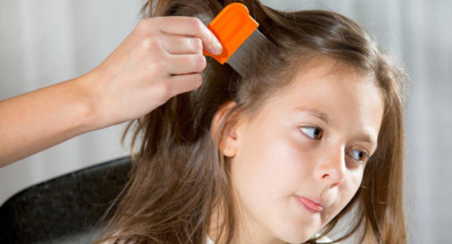 Chấy cùng tất cả những kiến thức về chấy